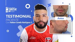 🧔🏻IMPLANTE DE BARBA TRANSPLANT ART  FABIAN CAMILO RODRÍGUEZ [upl. by Adnolat]