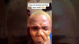 Nose oil is real  Her face has daily oil spillage  Blackheads Free [upl. by Ximenes676]