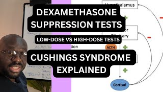 DEXAMETHASONE SUPPRESSION TESTS EXPLAINED  CUSHING SYNDROME  MEDICINE [upl. by Lirva114]