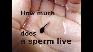 How much sperm live [upl. by Hsirk783]