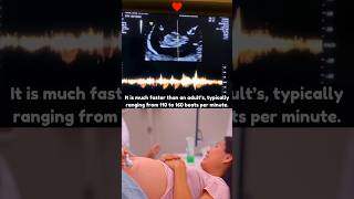 Fetal Heartbeat with Handheld Doppler [upl. by Assenav68]