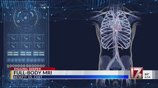 A fullbody MRI could catch disease early Is it worth the 3000 cost [upl. by Mota85]