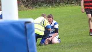 Batley Boys V Birstall 08  Caseys Kick in the mouth [upl. by Htilil]