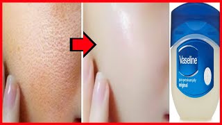 Apply Vaseline On Your Skin and See The Magic  Amazing 5 Vaseline Beauty Hacks  Beauty  Hacks [upl. by Crosse]