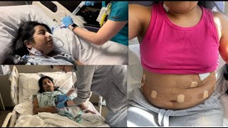 Hiatal Hernia Repair Surgery Vlog Raw Footage [upl. by Augustina569]