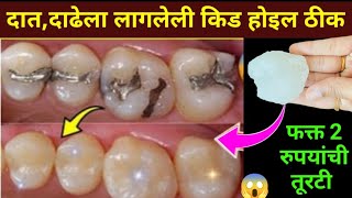 घरातील फक्त 2 वस्तू वापरा दातांन संबंधित सर्व समस्या दूर होतील😱 kitchen tips  home remedies  teeth [upl. by Ladnar]