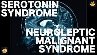 Serotonin Syndrome vs Neuroleptic Malignant Syndrome [upl. by Nelle]