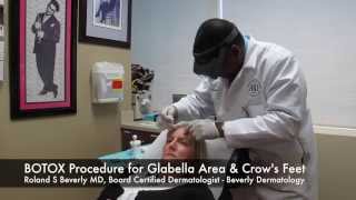 BOTOX Procedure on Glabella amp Crows Feet by Roland Beverly MD [upl. by Iblok]