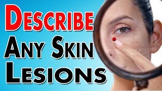 Describing Skin Lesions [upl. by Renie]