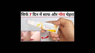 Melacare Cream Review in Hindi मेलाकेयर क्रीम के फायदे नुकसान उपयोग [upl. by Nyrak]