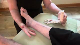 Part 1Hammer Toe Metatarsalgia BunionsMyofascial Treatment Solutions [upl. by Dorin]