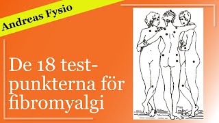 De 18 testpunkterna för fibromyalgi Tenderpoints ömma punkter triggerpunkter [upl. by Giorgio]