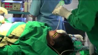 Hybrid technique for extubation of airway [upl. by Ioved]