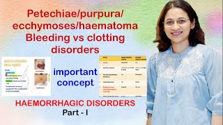 Petechiaepurpuraecchymoseshaematoma Clinical presentation of vesselplateletclotting disorders [upl. by Surtimed]