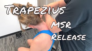 Trapezius Muscle Release  MSR Procedures [upl. by Yelnet]