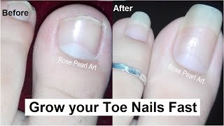 TRIMMING OF EXTREMELY THICK RAM’S HORN TOENAILS NOT CLICK BAIT [upl. by Duke675]