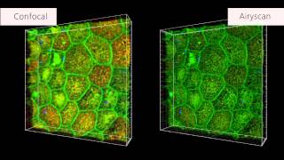 ZEISS LSM 880 with Airyscan Human intestinal stem cells [upl. by Mor568]