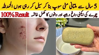 Multani Mitti Soap  Fast Acne Removal At Home  Pimples  Pigmentation [upl. by Risteau]