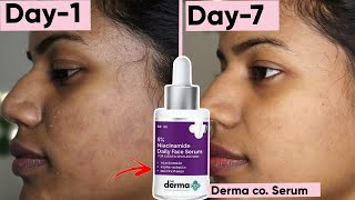 7day Derma Co Serum Challenge You wont believe what happened 😱 [upl. by Eboj]