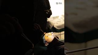 Icl Eye Surgery  Icl Eye Surgery for Vision Correction ytshorts iclsurgery procédure [upl. by Neahs208]