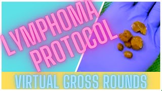 VGR  Lymphoma Protocol [upl. by Aara]