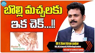 Treatment For Vitiligo Spots  DrkRavi Kiran Yadav  Masters Homeopathy  iDream Media [upl. by Eceinaj]