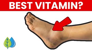 Top 5 Nutrients To Reduce Swelling In Feet amp Legs [upl. by Ruhtra]