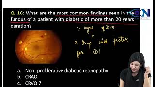 Ophthalmology PYQsFMGE30  Dr Niha Aggarwal [upl. by Suriaj]