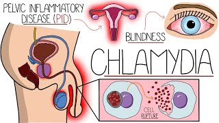 Understanding Chlamydia Chlamydia Trachomatis Explained Clearly [upl. by Best]