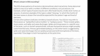 Understanding EEG Part 6Machine used in EEG diagnostic application signal recorded clinical use [upl. by Ranite]