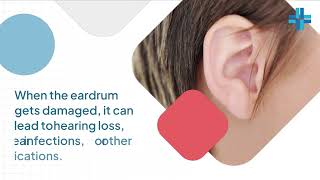 Ear drum perforation why it happens and treatments 0777 567 566 [upl. by Rehoptsirhc]