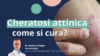 Cheratosi attinica come si cura  DermaPoint [upl. by Ahsinev]