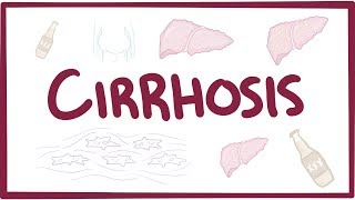 Cirrhosis  causes symptoms diagnosis treatment pathology [upl. by Enelehs]