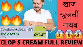 CLOP S Cream Full Review Effects and Side Effects Best for Fungal skin Infection खाज खुजली गायब 🔥😃😎👍 [upl. by Philomena]