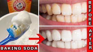 How to Whiten Teeth at Home With Baking Soda  A StepbyStep Tutorial [upl. by Sivek]