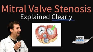 Mitral Valve Stenosis Explained Clearly  Pathophysiology Symptoms Treatment [upl. by Horne]