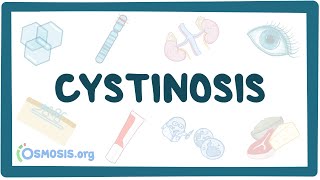 Cystinosis  causes symptoms diagnosis treatment pathology [upl. by Allicsirp]