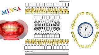 Odontograma MINSA e historia clínica [upl. by Wyatt]