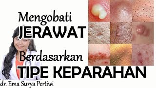 Mengobati JERAWAT PARAH berdasarkan Tipenya   dr Ema Surya P [upl. by Hawger]