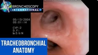 Flexible Bronchoscopy Introduction 7  Airway Inspection Tracheobronchial Anatomy [upl. by Frum]