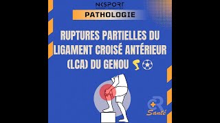 Rupture Partielle du LCA  Comprendre Diagnostiquer et Traiter LCA Kinésithérapie [upl. by Ahsahs]