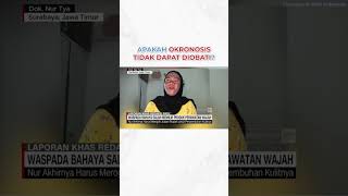 APAKAH OKRONOSIS TIDAK DAPAT DIOBATI clinicdevotrepeau treatmentwajah [upl. by Farrah]