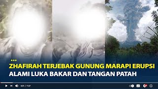 Kondisi Terkini Zhafirah Pendaki Terjebak Gunung Marapi Erupsi Alami Luka Bakar dan Tangan Patah [upl. by Sadonia]