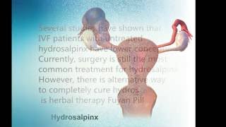 how to cure hydrosalpinx without surgery [upl. by Armahs923]