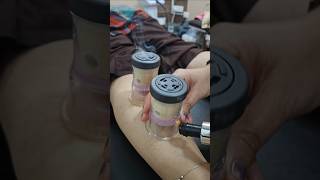 Moxibustion cupping for calfpainkneepainbackpainsciaticahipshoulderpain and blood circulation [upl. by Elletnahs584]