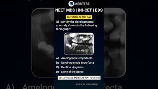 NEET MDS  INICET MDS  PSC  BDS  Most Important Questions neetmds2025 mdsprep [upl. by Epilef]