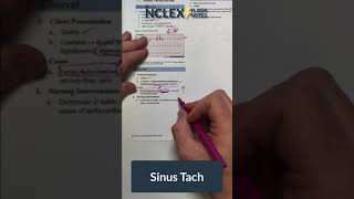 Sinus Tachycardia assessment and treatment [upl. by Asreht505]