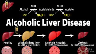 Alcoholic Liver Disease Animation [upl. by Rehpotsrik]