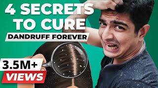 4 SECRET Tips To Remove Dandruff Forever  BeerBiceps Health [upl. by Karrie]