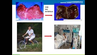 GASTROENTEROLOGÍA 8 Hepatitis fulminante [upl. by Griff]